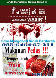 Obat Wasir Luar/Eksternal Bagus