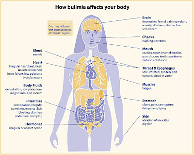 Treatment  Bulimia on The Binge   Purge Cycle Of Bulimia   Eating Disorders Center