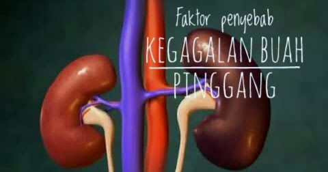 Simple Little Sharing By Collen: Faktor Penyebab Kegagalan 