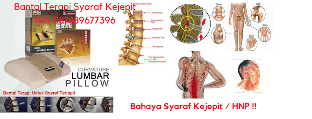 Syaraf Kejepit Bagian Leher, Saraf Lutut Kejepit, Ramuan Syaraf Kejepit