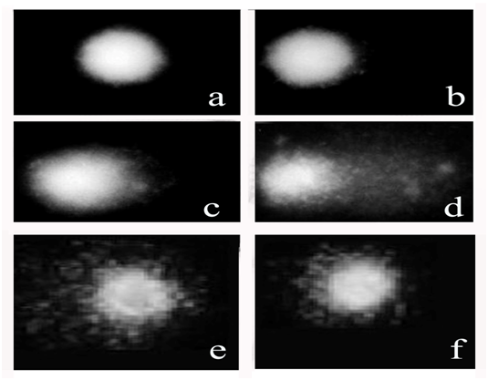 Intensity: Modulated Radiation Therapy, Mixed-Energy Plans; 6 MV, 15 MV, Prostate Cancer, Radiation Treatment Planning, Dose-Volumetric Analysis, The Journal of Radiology, Photon Journal, Photon Foundation