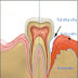Viêm nha chu điều trị ở đâu tốt nhất?