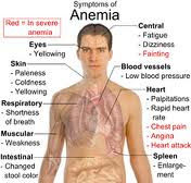 anemia, pengertian anemia, Blog Keperawatan