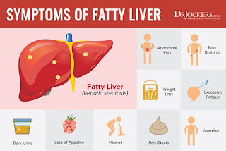 symptoms of NAFLD