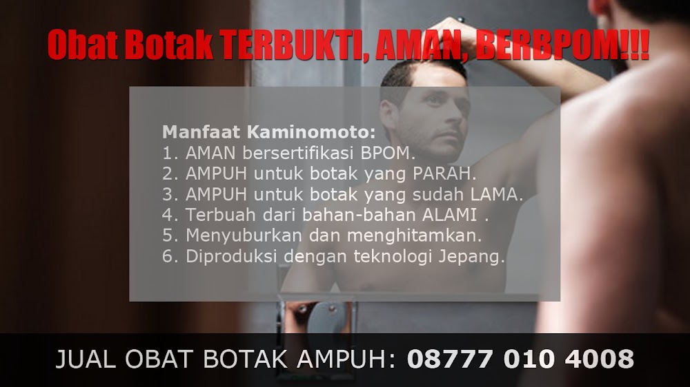 jual OBAT PENUMBUH RAMBUT BOTAK Sugapa<br/>