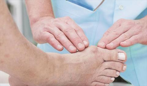Complications diagnosis and treatment of gout | healthy care