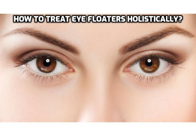 Treat Eye Floaters Holistically - This involves nutritional and lifestyle modification together with a natural supplementation regimen. Read on here to find out more.