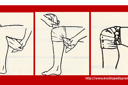 Gambar Luka Di Lutut / Petua Merawat Luka Kecil Secara Tradisional - Dan luka pun muncul pada bagian.