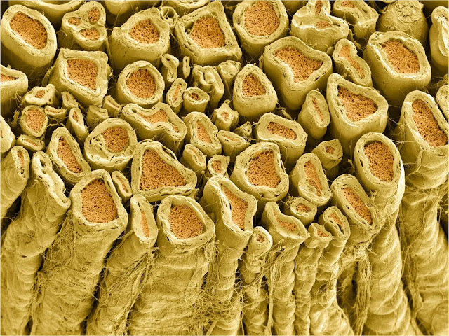 La mielina, que se muestra aquí en los nervios espinales de rata, forma una capa protectora y aislante alrededor de los axones. Curiosciencia