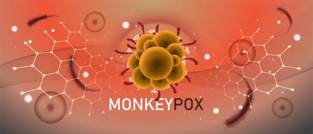 Monkeypox provavelmente provocará restrições de viagem à medida que a OMS considera a declaração de emergência