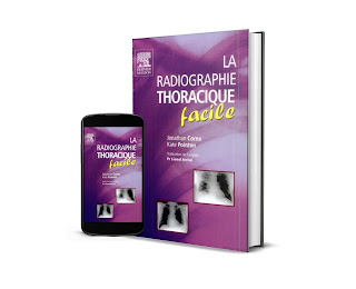 Radiographie thoracique facile pdf gratuit Télécharger le livre radiographie thoracique facile pdf gratuit livres,livre,gratuit,livres gratuits,livre gratuit,pdf,pdf livres gratuits,livres médicaux gratuit,livres gratuits en ligne,livres médicaux gratuits,les livres gratuits,ebook gratuit pdf téléchargements,pdf gratuit télécharger des ebooks,pdf gratuit sites de téléchargement,livres en pdf,livre pdf,télécharger ebook gratuit,ebooks téléchargement gratuit