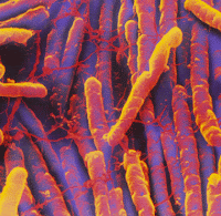 https://microbewiki.kenyon.edu/index.php/Clostridium_difficile-associated_disease