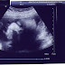 Me and baby Boy...2nd ultrasound today!!!