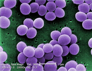  yang sanggup mengakibatkan aneka macam penyakit akhir dari infeksi pada jaringan badan  Bakteri Staphylococcus Aureus dan Bahayanya