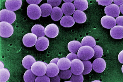 Bakteri Staphylococcus Aureus Dan Bahayanya