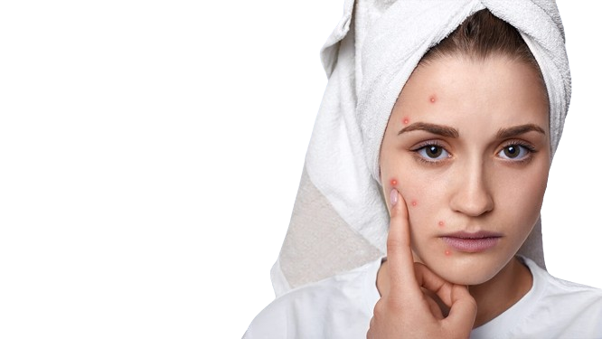 How to get rid of acne fast: 5 Worst foods for acne