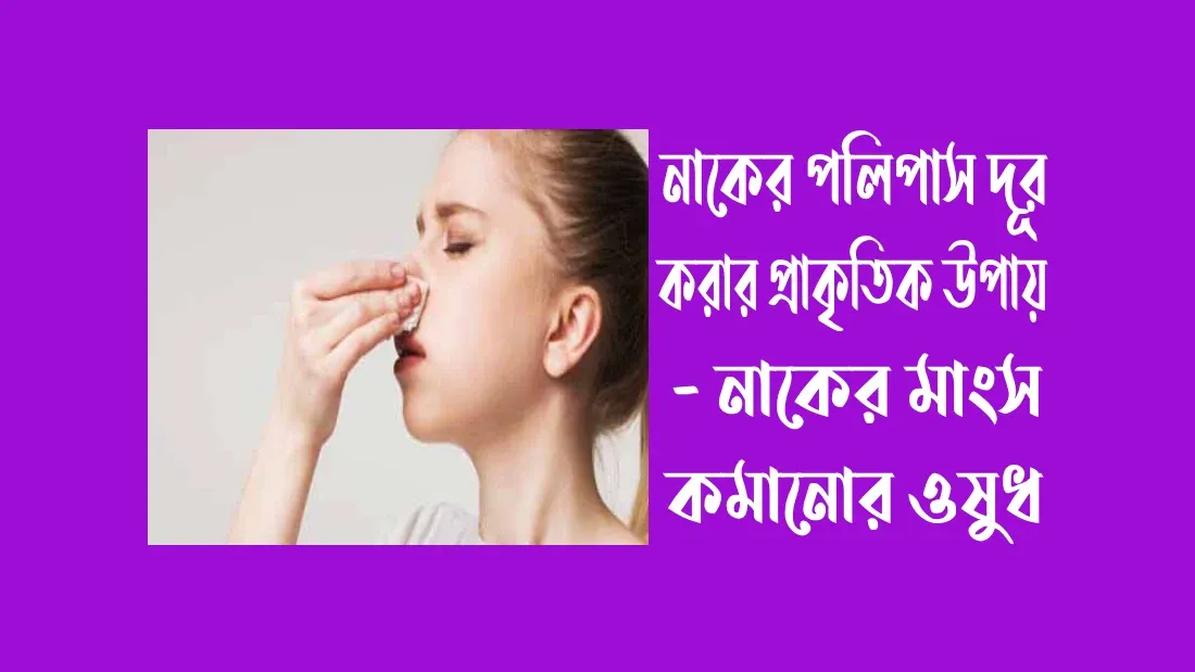 নাকের পলিপাস দূর করার প্রাকৃতিক উপায়