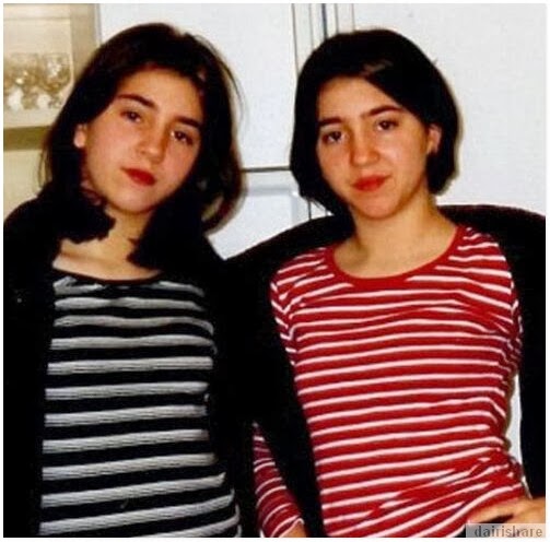 Pasangan Kembar Hobi Buat Pembedahan Plastik Dan Berkongsi 