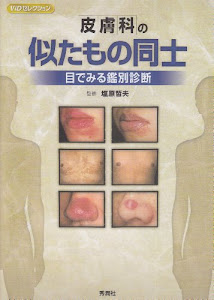 皮膚科の似たもの同士―目でみる鑑別診断 (ViDセレクション)