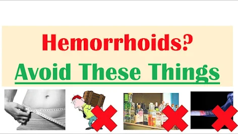 Top Tips To Prevent Hemorrhoids
