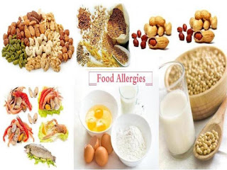 Home Remedies For Food Allergy, Effective Natural Treatment