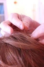 hair loss in women. Holding a hair from the hand of a woman's head