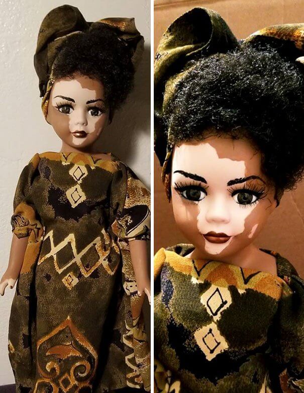 Artist Creates Dolls With Vitiligo To Support Children Who Have This Skin Condition