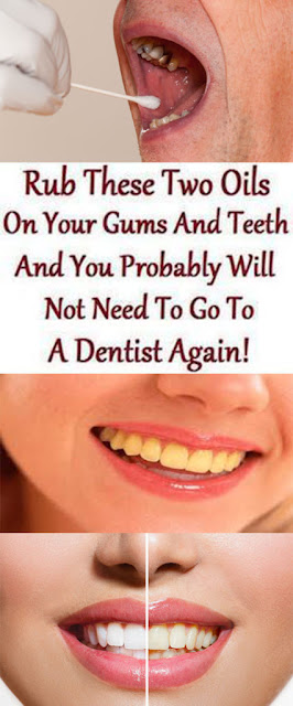 Rub These Two Oils On Your Gums And Teeth And You Probably Will Not Need To Go To Dentist Again