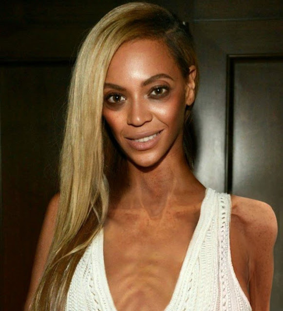 Beyonce Knowles anoreksja , anorexia , anorektic, anorectic , anorexia nervosa