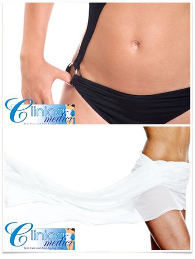 bikini line hair removal. with a Bikini Line IPL at