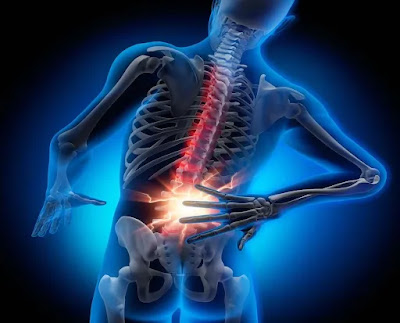 How to Treat Ankylosing Spondylitis