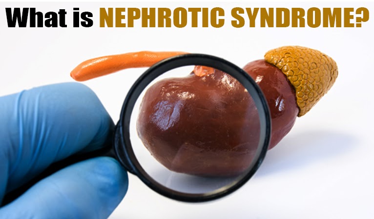 What is nephrotic syndrome?