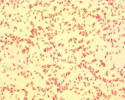 serratia marcescens  diseases