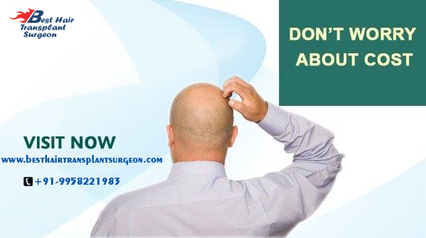 hair transplant in delhi