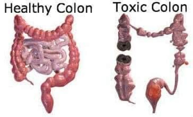 La détoxification du côlon est sans nul doute l’une des meilleures techniques d’assainissement du corps 