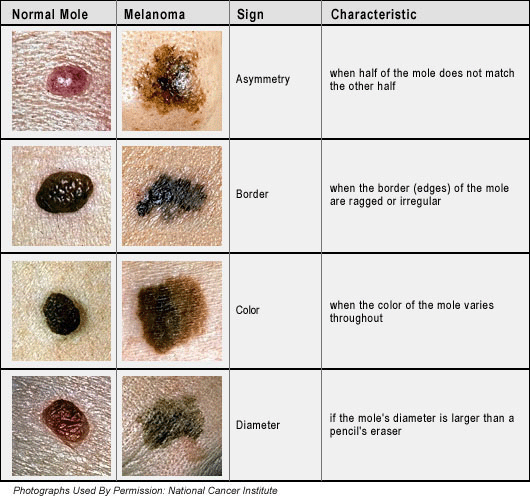 Become a Homeopathy expert: Moles