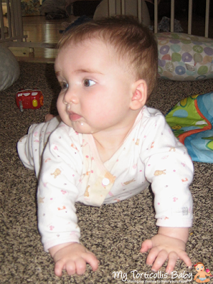 Baby with right torticollis doing tummy time