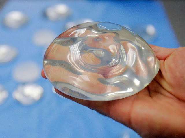 New Breast Implant Guidance From FDA Wants Stronger Warning About Risks Including Cancer