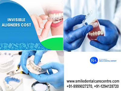 Orthodontic Dental Clinic offer Dental Braces Treatment And Best Invisible Aligner Treatment in Faridabad