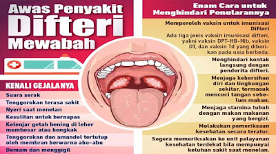 Ciri-ciri Terjangkit Penyakit Difteri