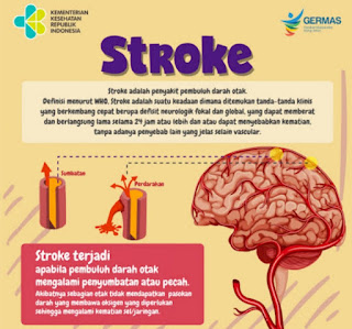 Jangan Sampai Kena Stroke, Cegah dengan CERDIK dan #SeGeRaKeRS