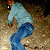 थाना आलमबाग क्षेत्र में शातिर लुटेरा मुठभेड़ में घायल