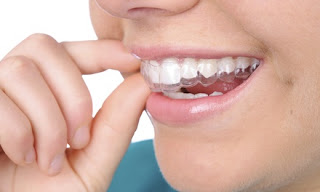 Invisalign Flemington Treatment