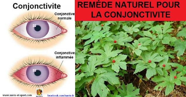 REMEDE-NATUREL-CONJONCTIVITE