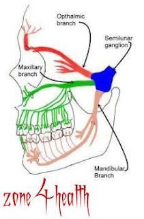 What is Toothache ?