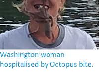 https://sciencythoughts.blogspot.com/2019/08/washington-woman-hospitalised-by.html