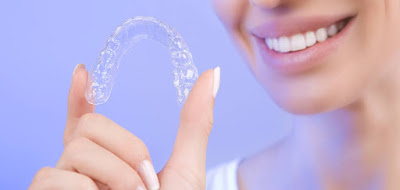 Quy trình niềng răng không mắc cài 3D Clear 