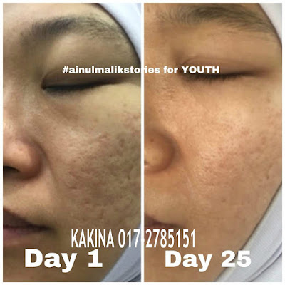 Testimony Youth SKINCARE