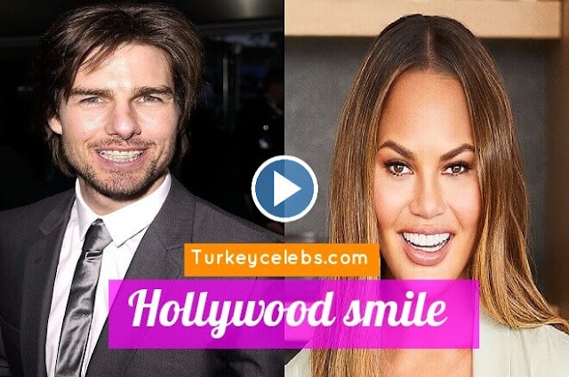 Celebrities used orthodontics to get a Hollywood smile .