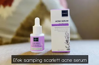 Efek Samping Scarlett Acne Serum